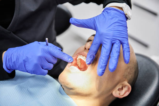 Best Emergency Wisdom Teeth Removal in Sparks, NV